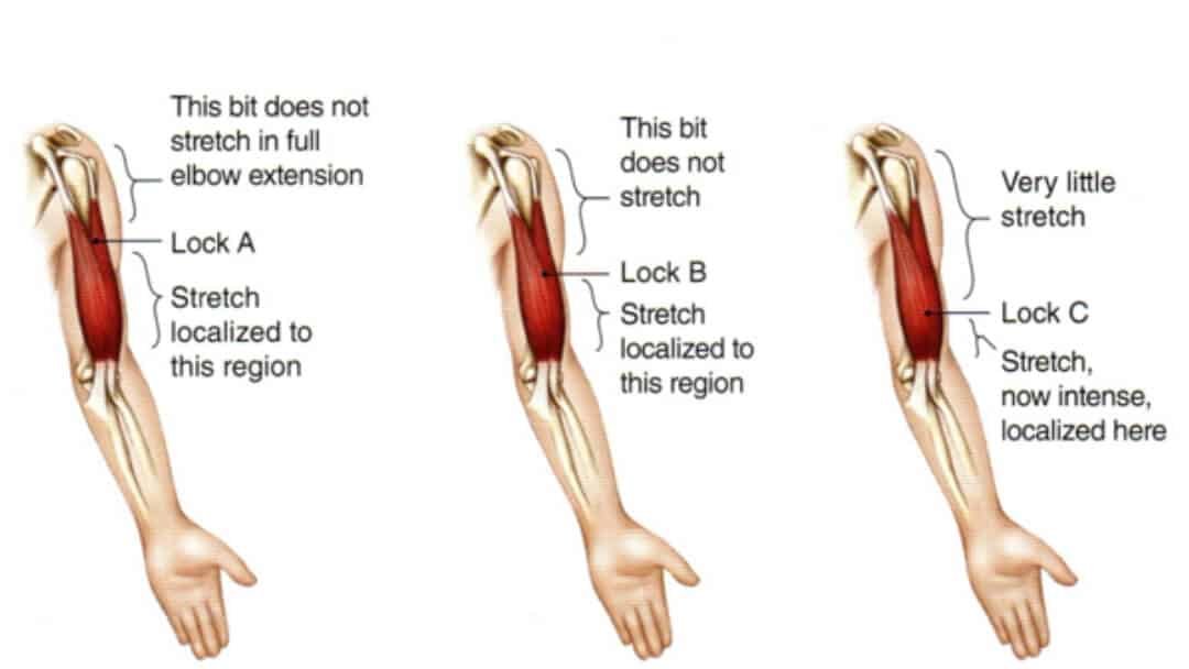 Anatomiškai pavaizduoti dvigalvio žasto raumenys ir kaip būtu taikomas Minkštųjų audinių atpalaidavimas (Soft Tissue Release) naudojant užrakink ir tempk techniką