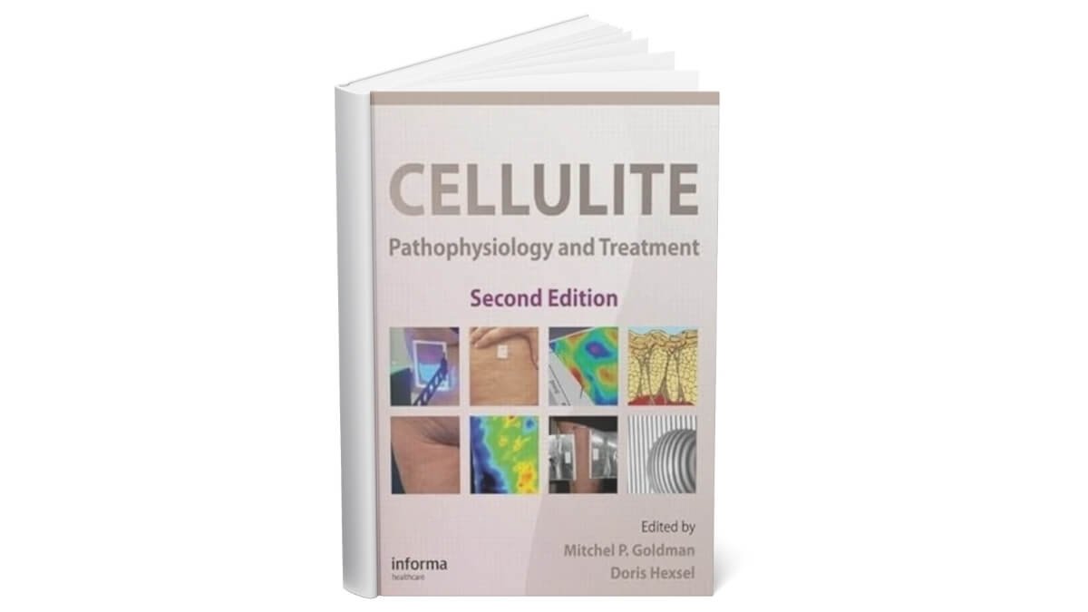Knygos Viršelis Cellulite Pathophysiology And Treatment.