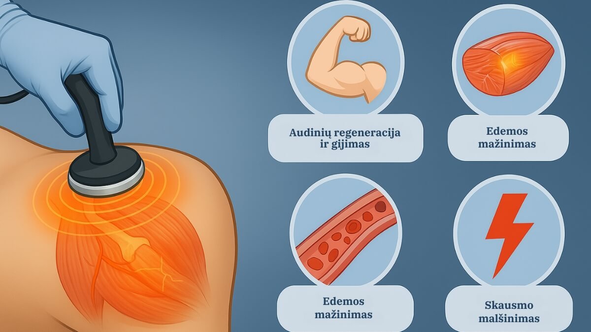 Smūginės Bangos Terapija (Shockwave Therapy). Pateikti Du Iš Esmės Skirtingi Smūginių Bangų Tipai.