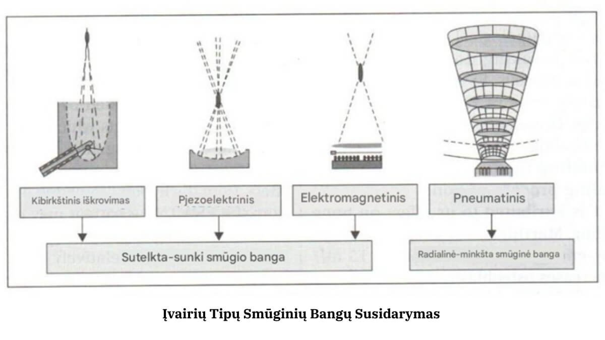 Smūginės Bangos Terapija (Shockwave Therapy). Pateikti Du Iš Esmės Skirtingi Smūginių Bangų Tipai.