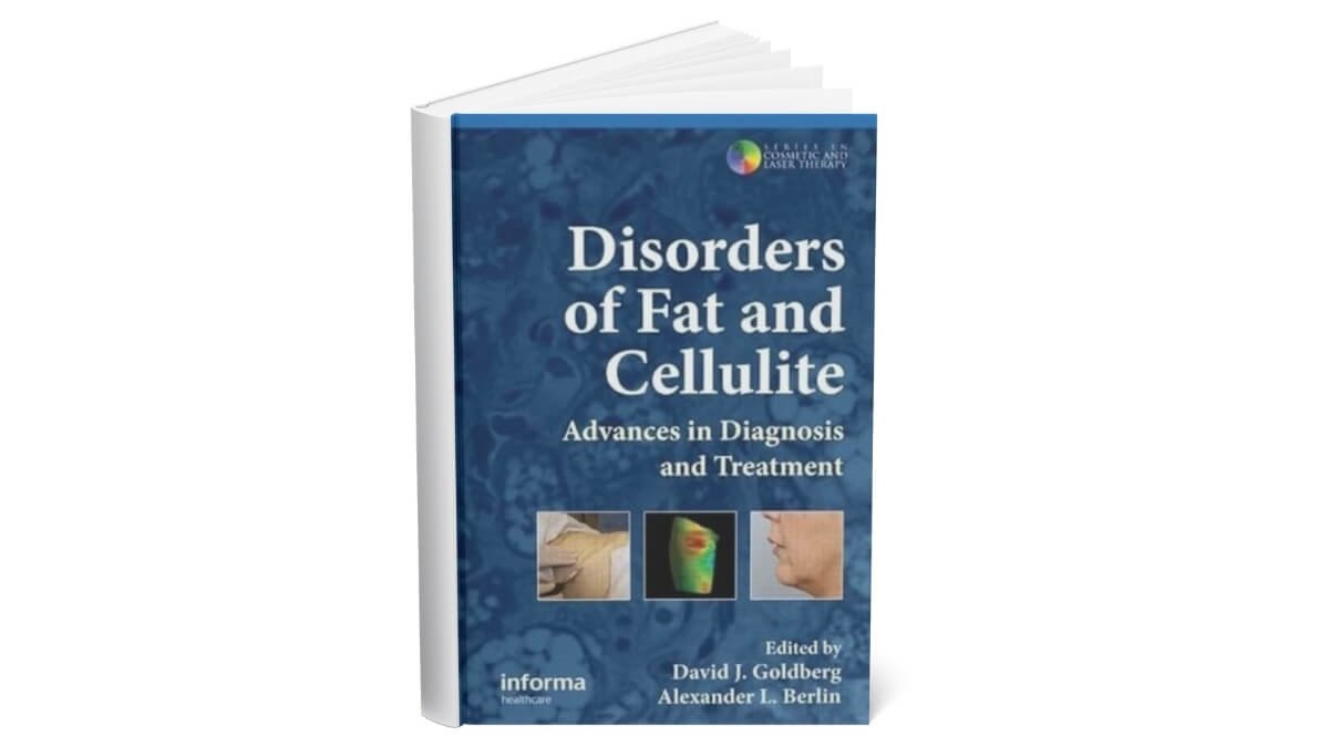 Knygos Viršelis Disorders of Fat and Cellulite: Advances in Diagnosis and Treatmen