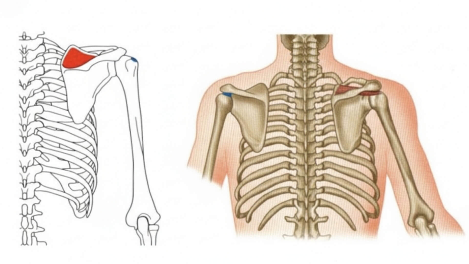 Antdyglinis Raumuo (Supraspinatus) Peties Skausmo Testavimas Antdyglinis Raumuo (Supraspinatus) Peties Skausmo Testavimas. Antdyglinio raumens (supraspinatus) anatomija ir prisitvirtinimo vietos mentės bei peties srityje.
