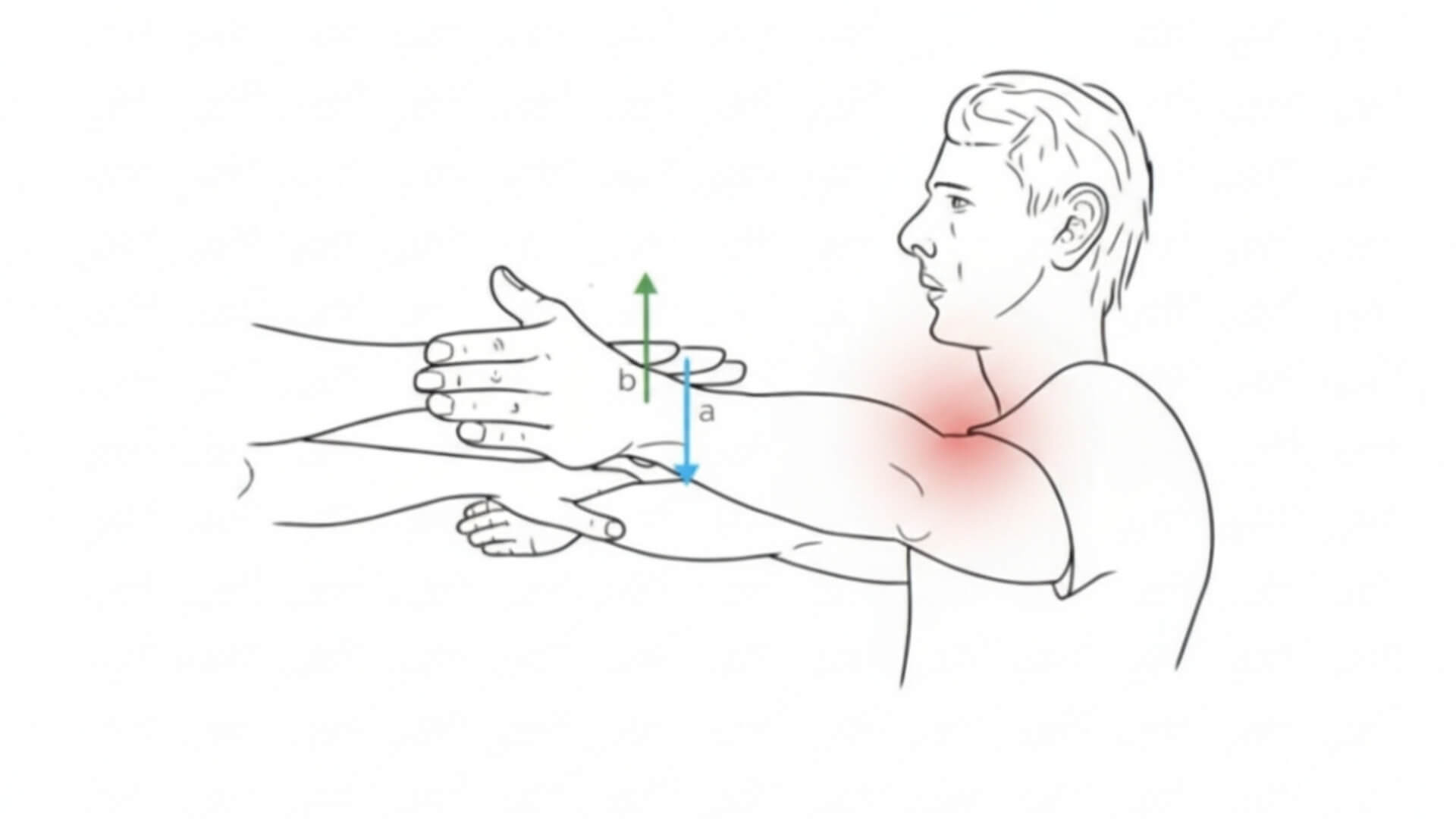 Antdyglinis Raumuo (Supraspinatus) Peties Skausmo Testavimas Antdyglinis Raumuo (Supraspinatus) Peties Skausmo Testavimas. Pilnos skardinės testas (Full Can Test) supraspinatus sausgyslės ir peties skausmo vertinimui.