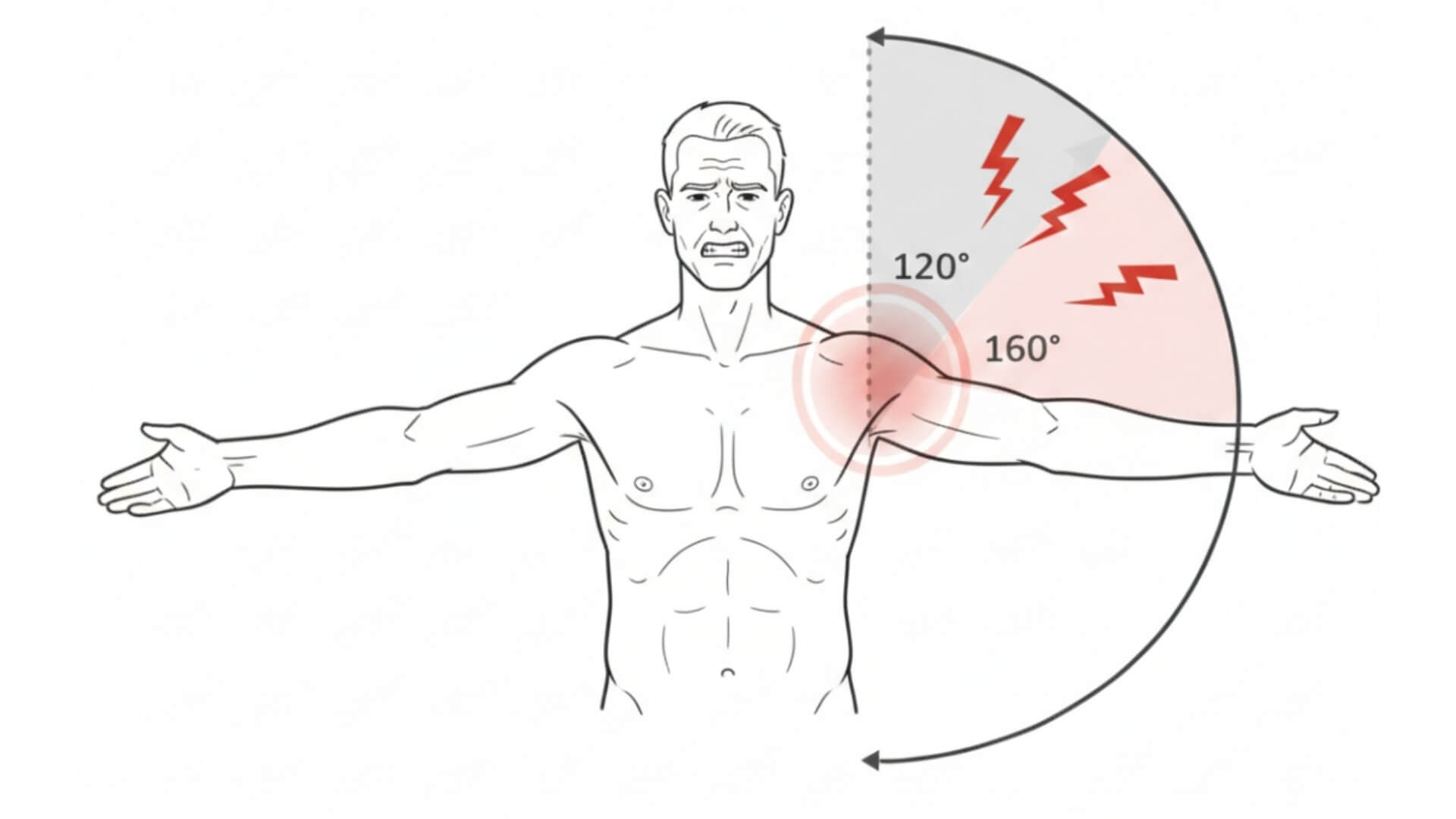 Antdyglinis Raumuo (Supraspinatus) Peties Skausmo Testavimas Antdyglinis Raumuo (Supraspinatus) Peties Skausmo Testavimas. Skausmingo lanko testas (Painful Arc Test) peties skausmo ir supraspinatus raumens pažeidimo vertinimui.