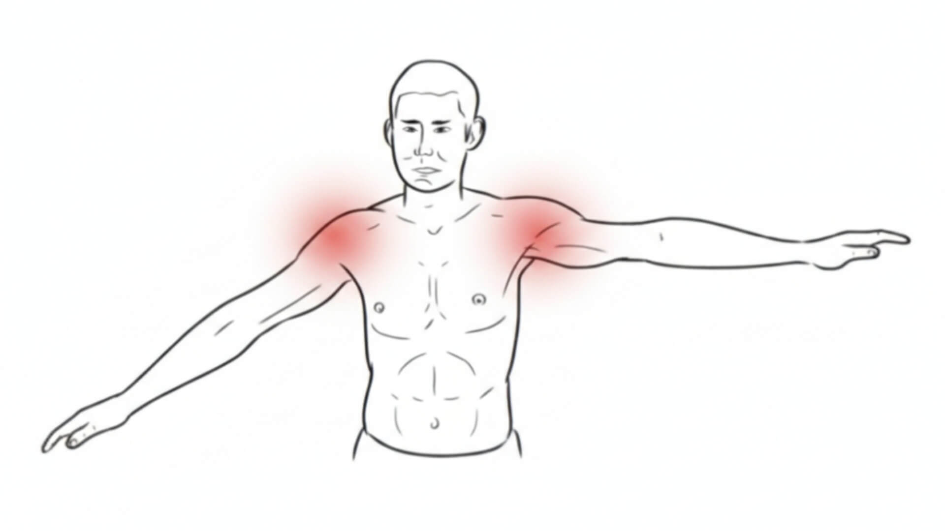 Antdyglinis Raumuo (Supraspinatus) Peties Skausmo Testavimas Antdyglinis Raumuo (Supraspinatus) Peties Skausmo Testavimas. Nuleistos rankos testas (Drop Arm Test) supraspinatus raumens silpnumo ir rotatorių manžetės pažeidimo vertinimui.