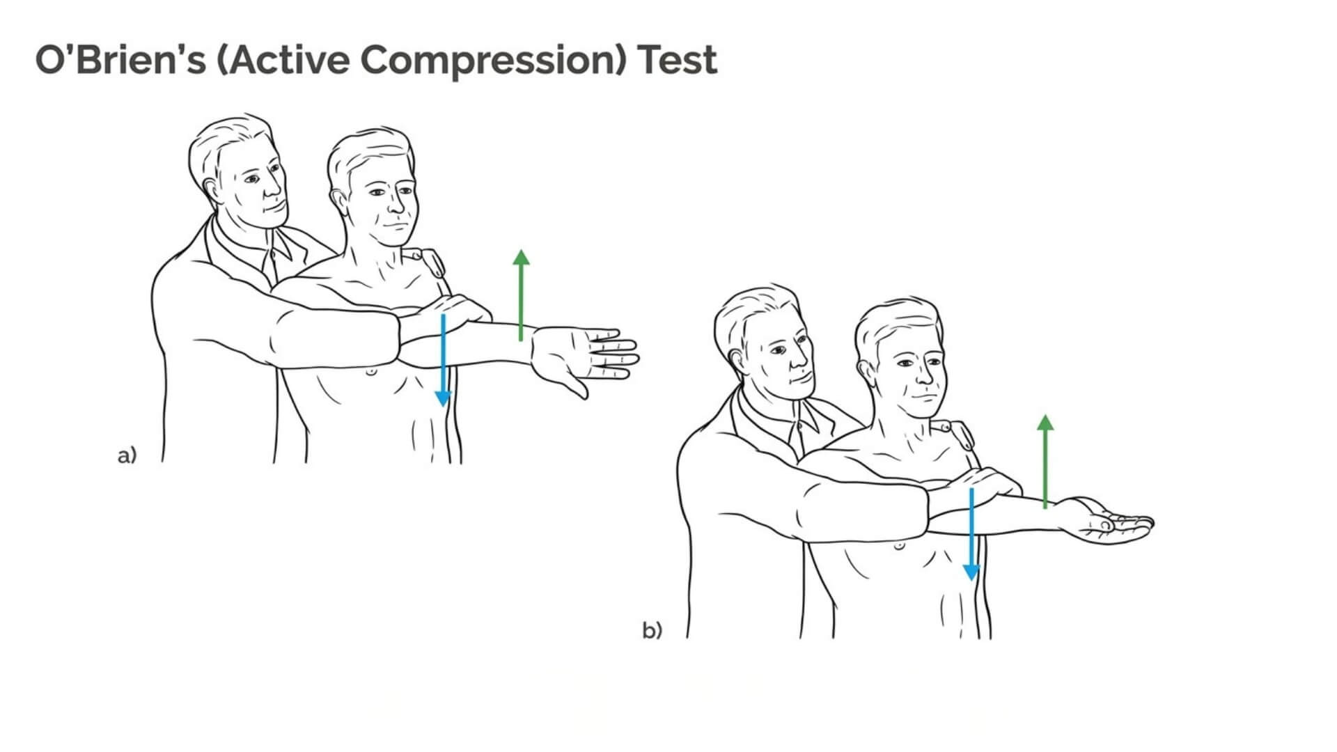 Akromioklavikulinio Sąnario Testavimas (Acromioclavicular Joint Test) Akromioklavikulinio Sąnario Testavimas (Acromioclavicular Joint Test). O’Brien (aktyviosios kompresijos) testas: pacientas laiko petį sulenktą ir pritrauktą, atliekamas testas su vidine peties rotacija ir pronacija bei išorine rotacija ir supinacija, taikant pasipriešinimą dilbio judesiui.