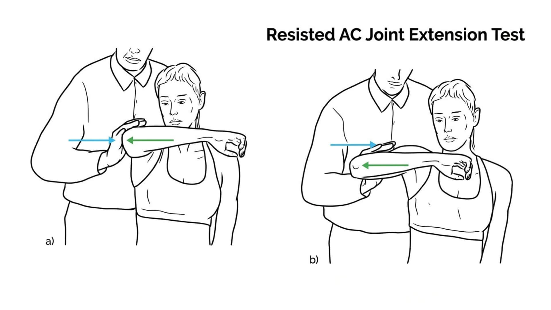 Akromioklavikulinio Sąnario Testavimas (Acromioclavicular Joint Test) Akromioklavikulinio Sąnario Testavimas (Acromioclavicular Joint Test). Pasipriešinimo AC sąnario tiesimo testas: pacientui sėdint ir laikant petį 90° sulenktą bei vidinės rotacijos padėtyje, atliekamas horizontalus rankos tiesimas prieš specialisto taikomą pasipriešinimą.