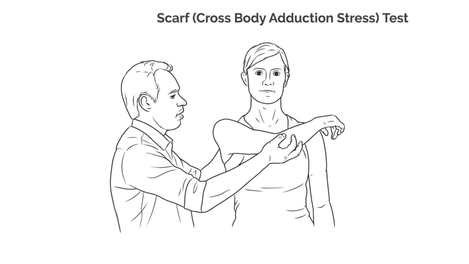 Akromioklavikulinio Sąnario Testavimas (Acromioclavicular Joint Test) Akromioklavikulinio Sąnario Testavimas (Acromioclavicular Joint Test). Scarf (kryžminės kūno linijos pritraukimo streso) testas: specialistas pasyviai pritraukia paciento 90° kampu sulenktą ranką per kūną, stabilizuodamas mentę ir vertindamas AC sąnario skausmą.