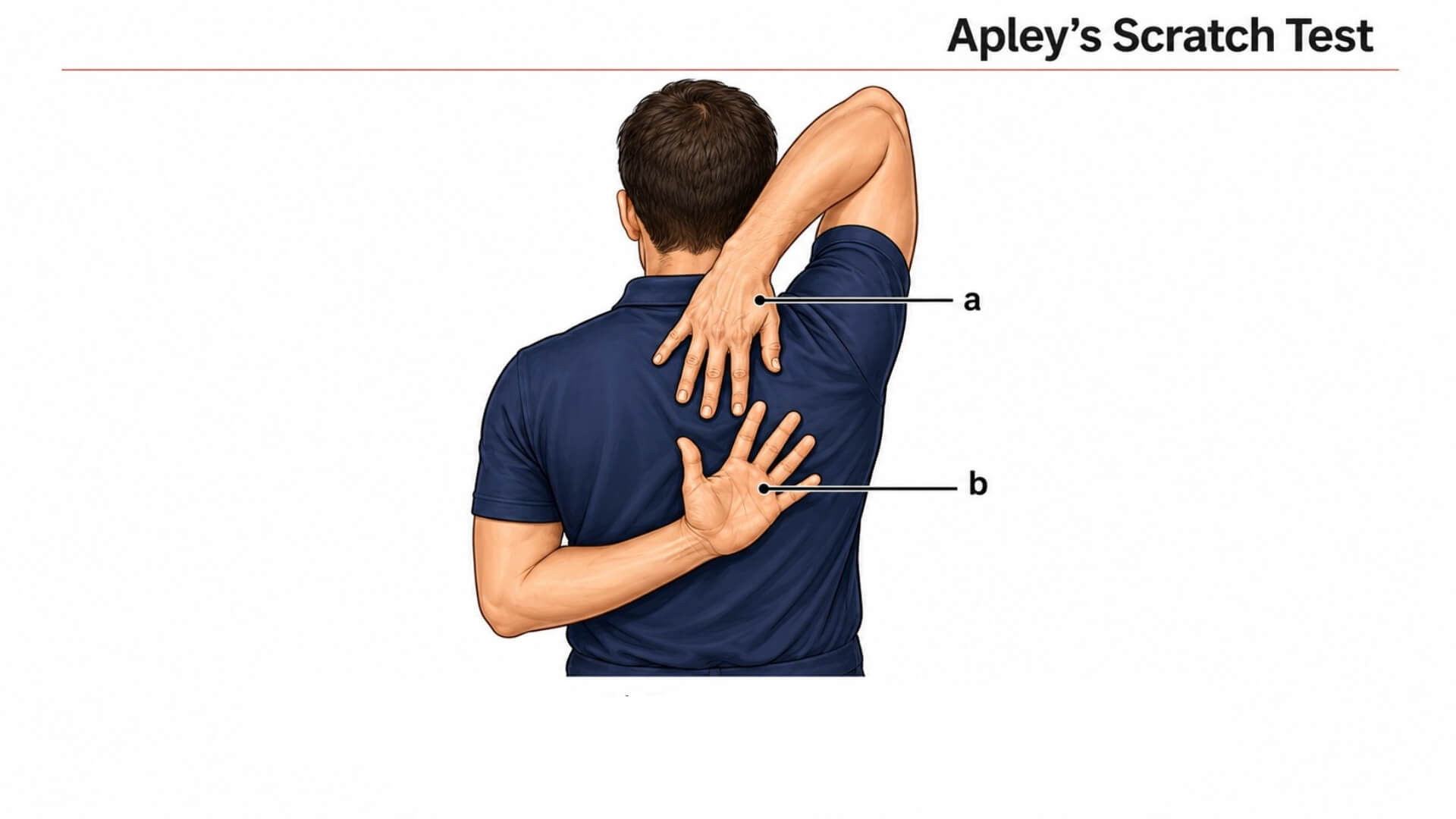 Mentės–Krūtinės Ląstos Sąnario Testas (Scapulothoracic Joint Test) Mentės–Krūtinės Ląstos Sąnario Testas (Scapulothoracic Joint Test). Apley kasymosi testas: ranka siekiama viršutinės nugaros dalies iš viršaus ir nugaros iš apačios.
