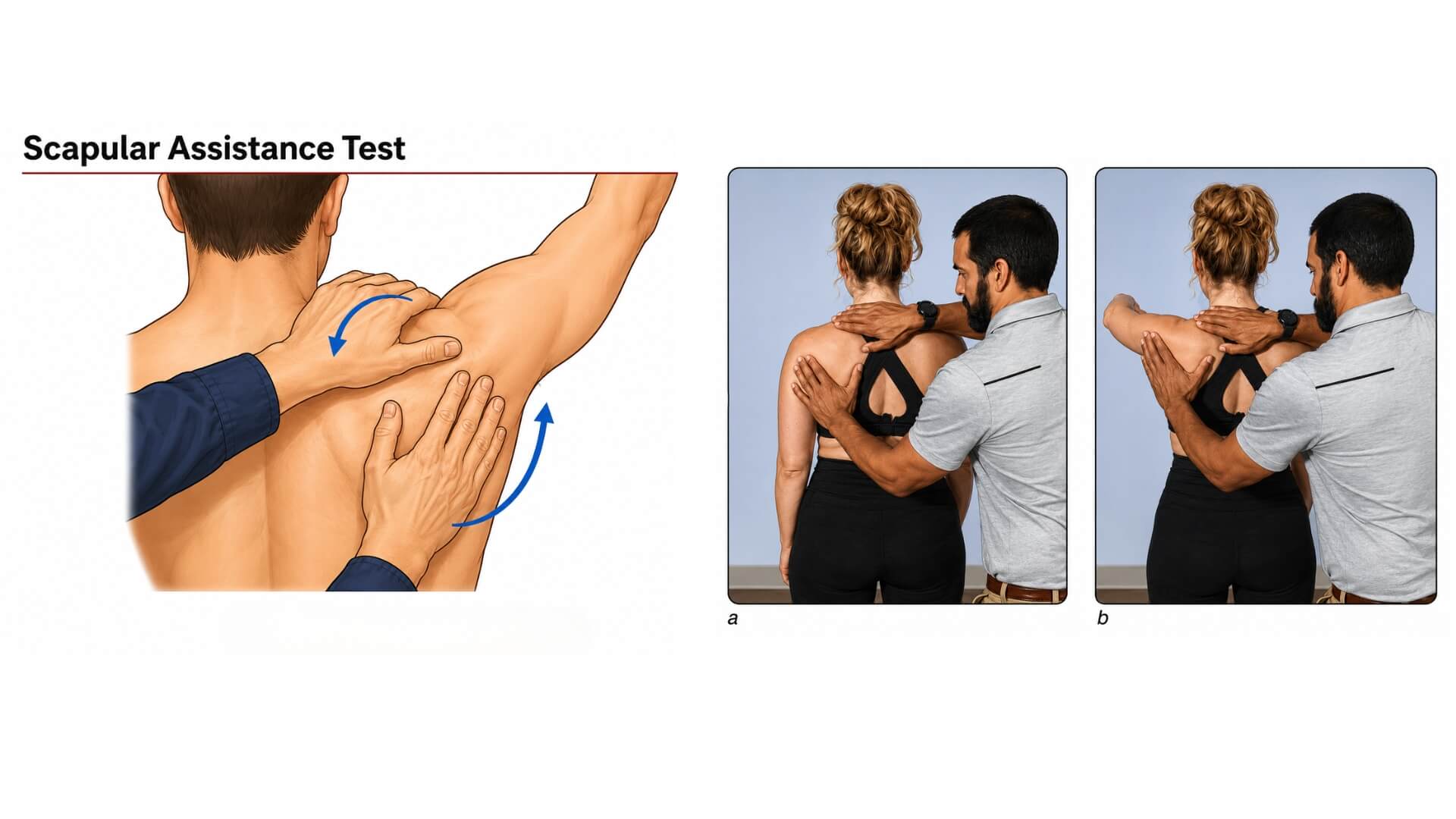 Mentės–Krūtinės Ląstos Sąnario Testas (Scapulothoracic Joint Test) Mentės–Krūtinės Ląstos Sąnario Testas (Scapulothoracic Joint Test). Mentės asistavimo testas: specialistas rankomis asistuoja mentės judėjimui keliant kliento ranką.