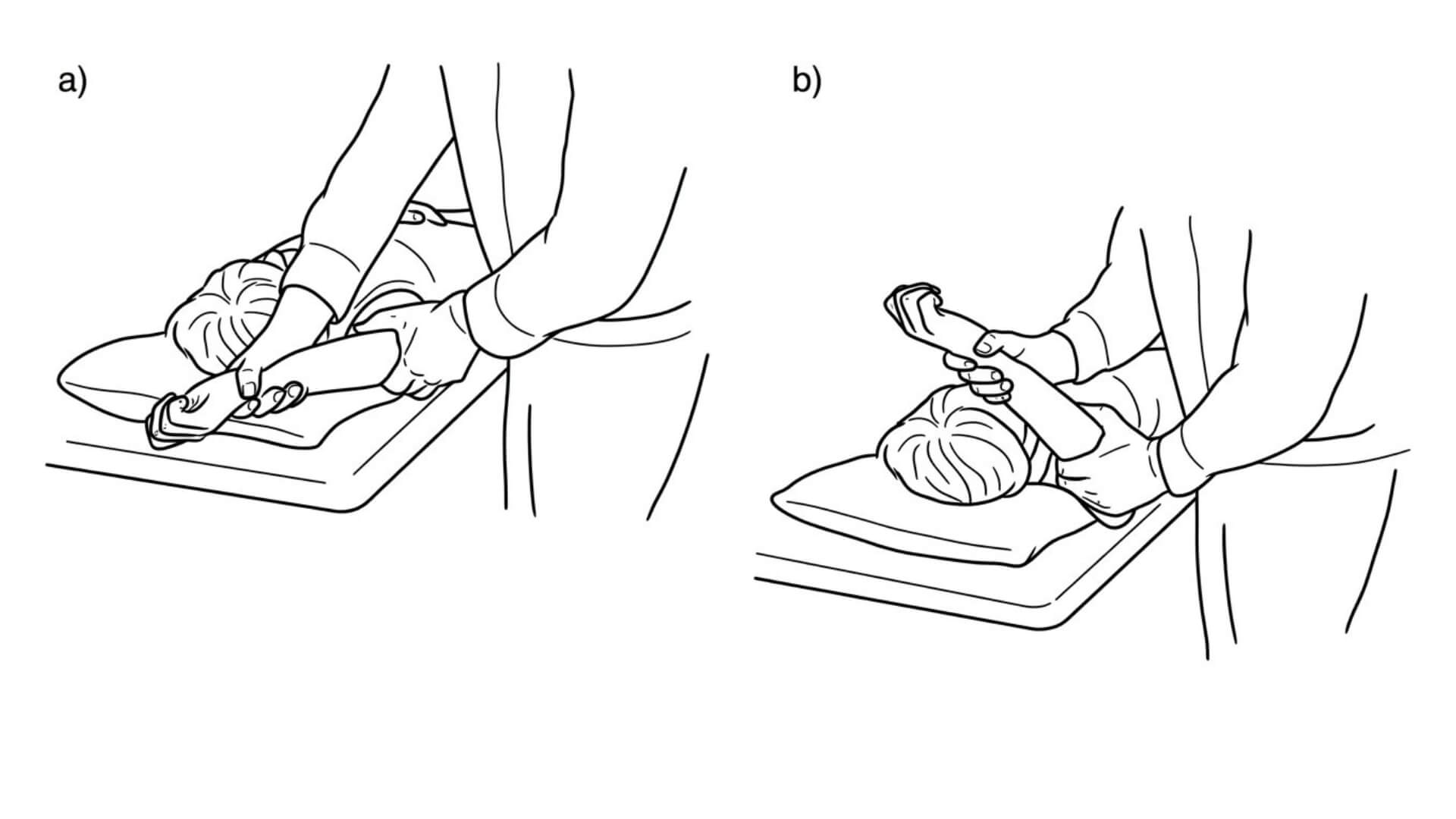 Glenohumeralinio Sąnario Lūpos Testas (Labrum of the Glenohumeral Joint) Glenohumeralinio Sąnario Lūpos Testas (Labrum of the Glenohumeral Joint). „Crank“ kompresinės rotacijos testas peties sąnario lūpos pažeidimams vertinti.